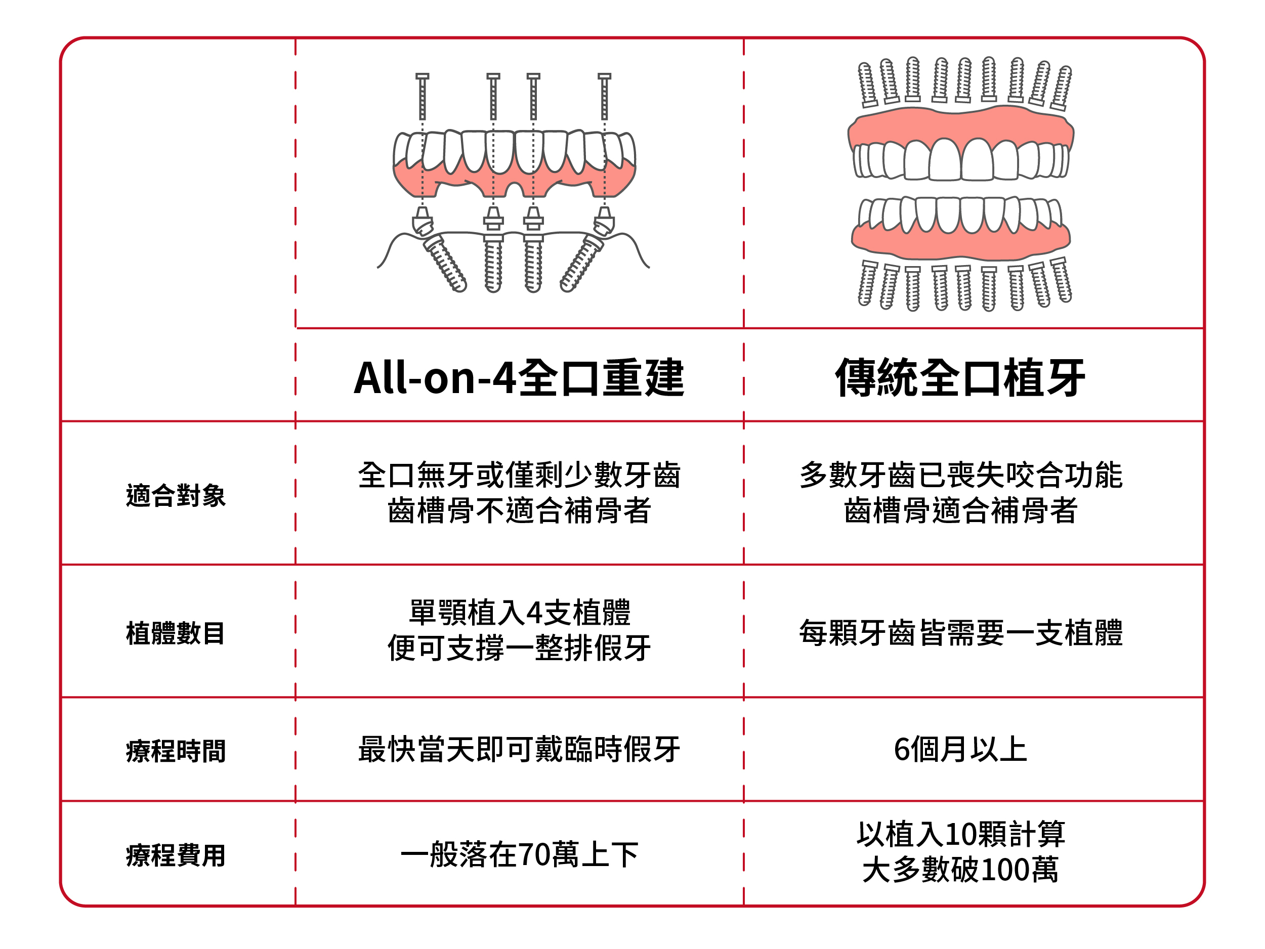 All-On-4全口重建與傳統全口植牙的差異？